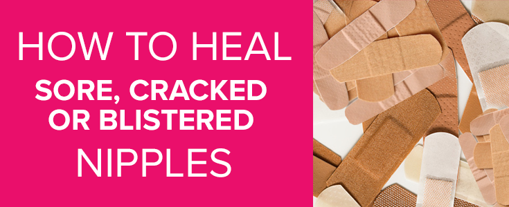 How to heal sore, cracked or blistered nipples. – Back to Mom