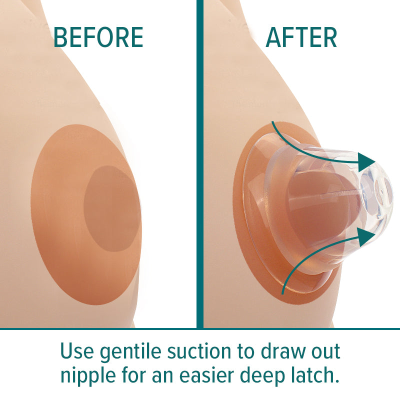 Nipple corrector helps draw out nipples to make baby latch better. Get a deep latch every time with Nip assist latch helpers.