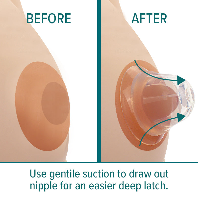 Nipple corrector helps draw out nipples to make baby latch better. Get a deep latch every time with Nip assist latch helpers. 